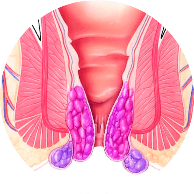 Gelarex lajša simptome že po prvi uporabi